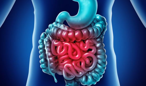 Desarrollan un implante blando e inalámbrico que trata la enfermedad inflamatoria intestinal 