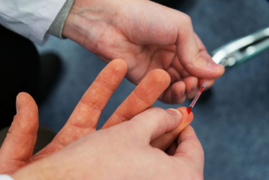 Un estudio detecta diferencias entre hombres y mujeres en las proteínas en sangre en el alzhéimer Un estudio detecta diferencias entre hombres y mujeres en las proteínas en sangre en el alzhéimer