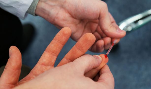 Un pinchazo en el dedo podría ayudar a detectar el alzhéimer de forma precoz