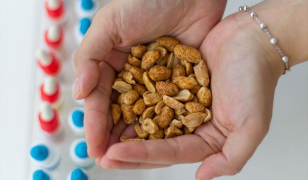 Una dosis mínima de cacahuete protege a niños alérgicos con menos riesgos. Fuente: Europa Press.