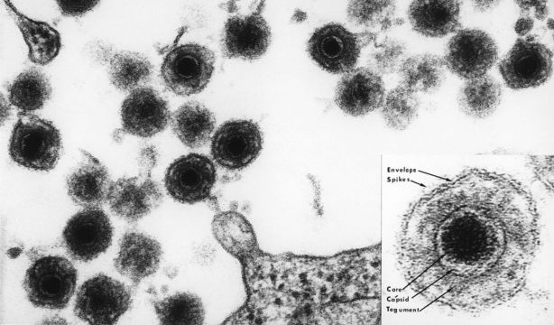 Los herpes infantiles que viajan con nosotros desde la Edad de Hierro. Fuente: Europa Press.