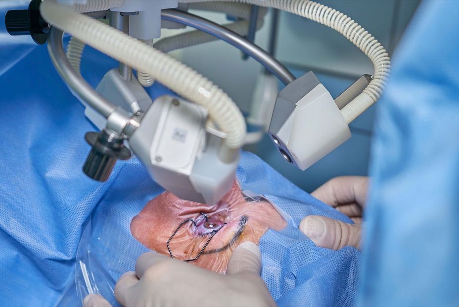 Imagen de una operación de cataratas. Fuente: Europa Press.