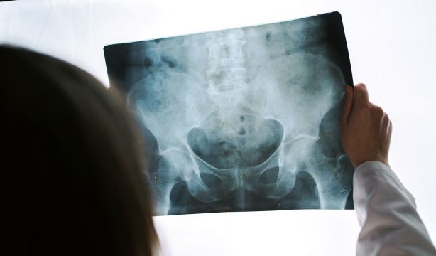 Osteomielitis púbica: qué es, síntomas y tratamiento . (Bigstock)