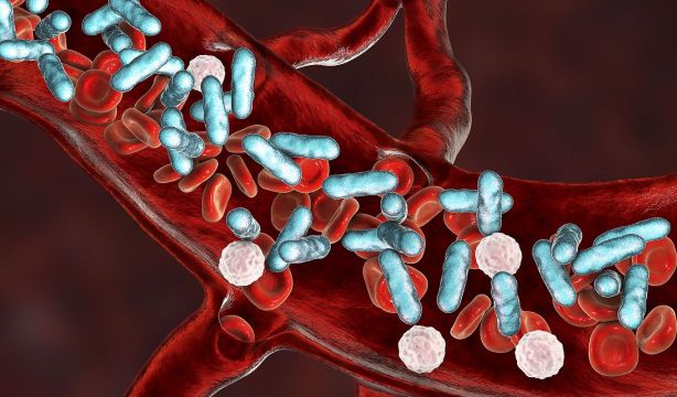 Un modelo de IA anticipa el riesgo de sepsis tras una cirugía. Foto: Bigstock.