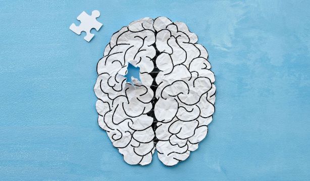 Cómo afecta la tristeza a la salud del cerebro. Fuente: BigStock.