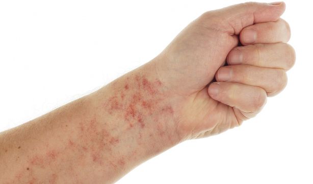 Una nueva tecnología 've' signos tempranos de patologías cardiacas a través de la piel. (Bigstock)