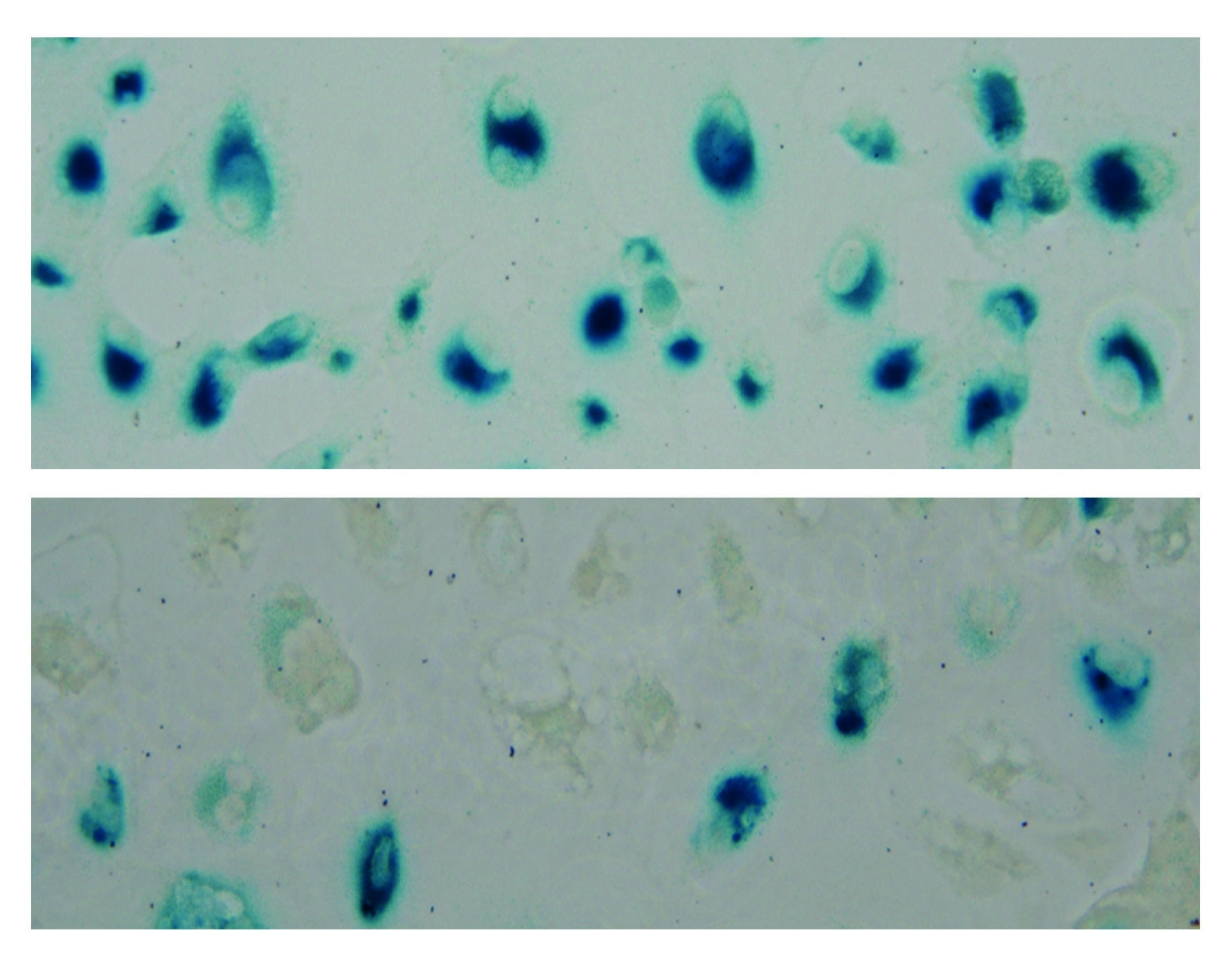 Un compuesto derivado de la anémona del mar Caribe podría mejorar el tratamiento contra el cáncer