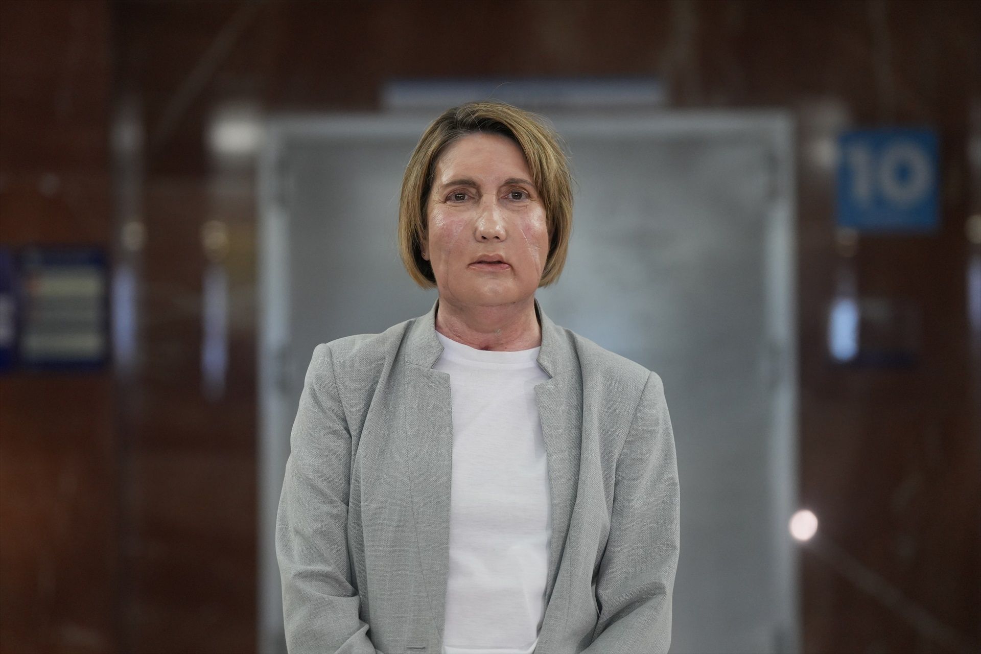 Primer trasplante de cara del mundo a partir de una donante que recibió la eutanasia