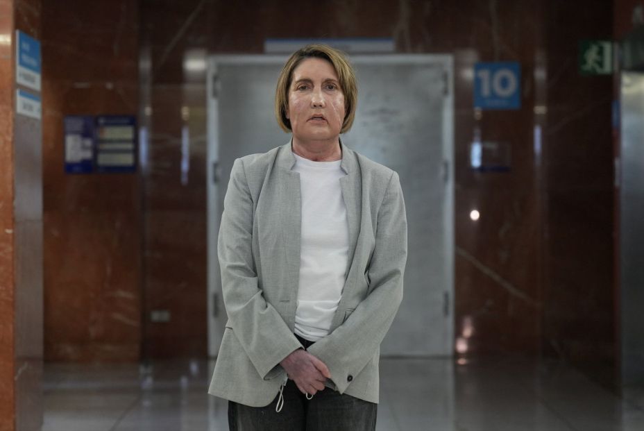 Primer trasplante de cara del mundo a partir de una donante que recibió la eutanasia