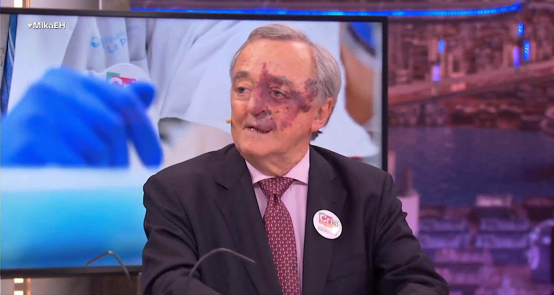 Barbacid explica cómo ha eliminado el cáncer de páncreas en ratones y cuándo llegará a pacientes