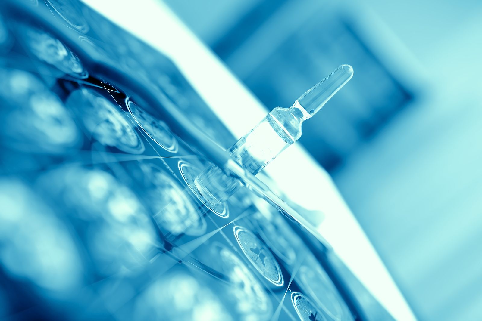 Encuentran una nueva forma de retrasar la pérdida de memoria en el alzhéimer. (Bigstock)