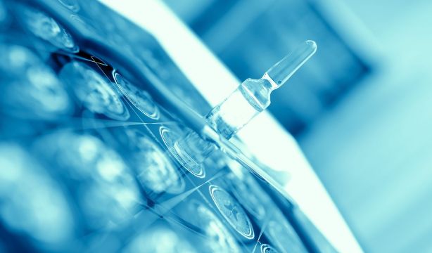 Encuentran una nueva forma de retrasar la pérdida de memoria en el alzhéimer. (Bigstock)