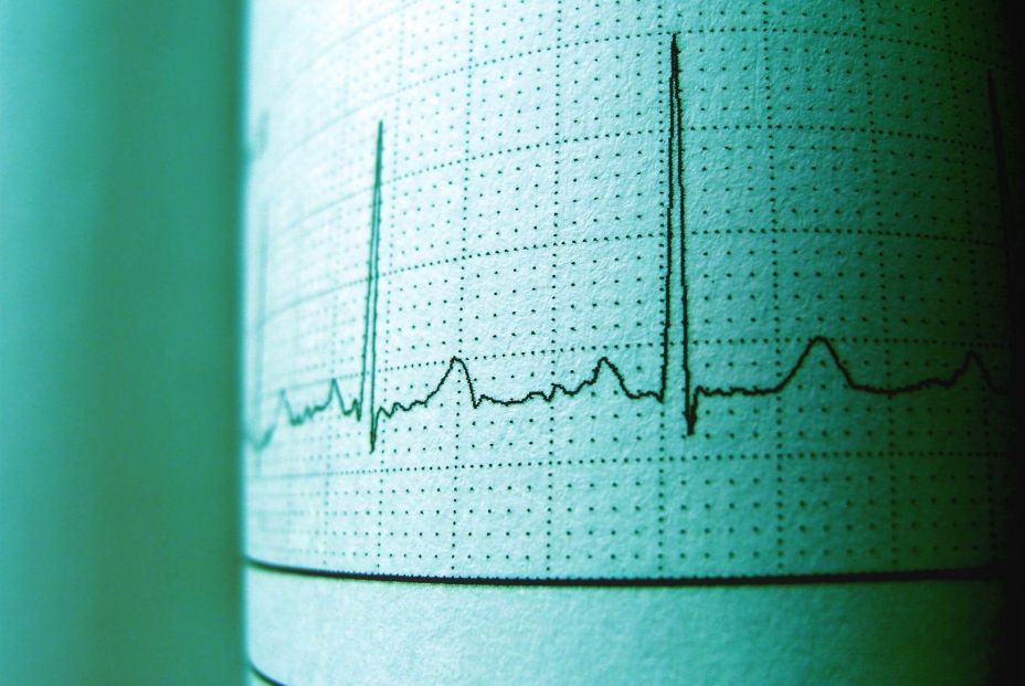 La investigación abre nuevas vías para mejorar el tratamiento de las arritmias persistentes. Fuente: Europa Press. La investigación abre nuevas vías para mejorar el tratamiento de las arritmias persistentes. Fuente: Europa Press.
