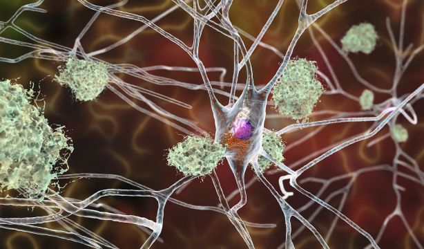 Encuentran una preocupante relación entre el herpes labial con síntomas propios del alzhéimer
