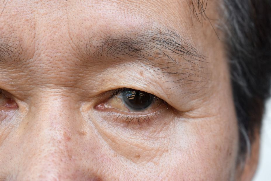 bigstock Skin Creases Around The Eye Of 466175081