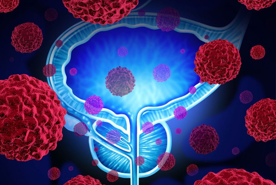 Combinar radioterapia y terapia génica es eficaz y seguro para tratar varios tipos de cáncer