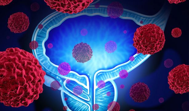 Combinar radioterapia y terapia génica es eficaz y seguro para tratar varios tipos de cáncer