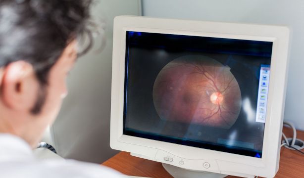 Bacterias comunes en los ojos se relacionan con el alzhéime. (Bigstock)