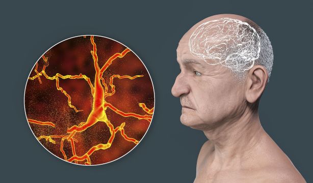 Descubren que los cerebros de los 'superancianos' son más fértiles neuronalmente