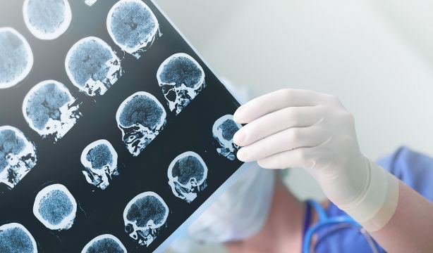 Un estudio identifica una ruta cerebral "decisiva" para el funcionamiento de la memoria de trabajo