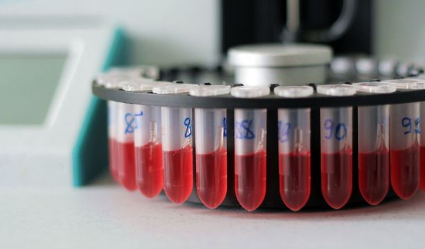 Un nuevo anticoagulante reduce el riesgo de ictus sin aumentar el riesgo de hemorragia