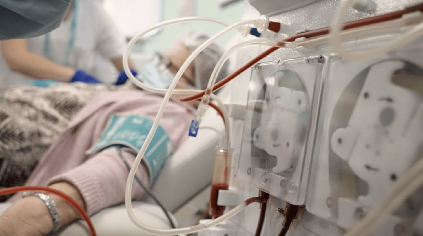 La enfermedad renal crónica aumenta con más de 68.000 personas en tratamiento renal sustitutivo