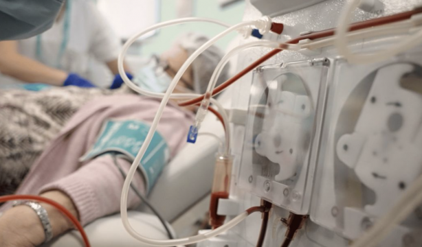 La enfermedad renal crónica aumenta con más de 68.000 personas en tratamiento renal sustitutivo