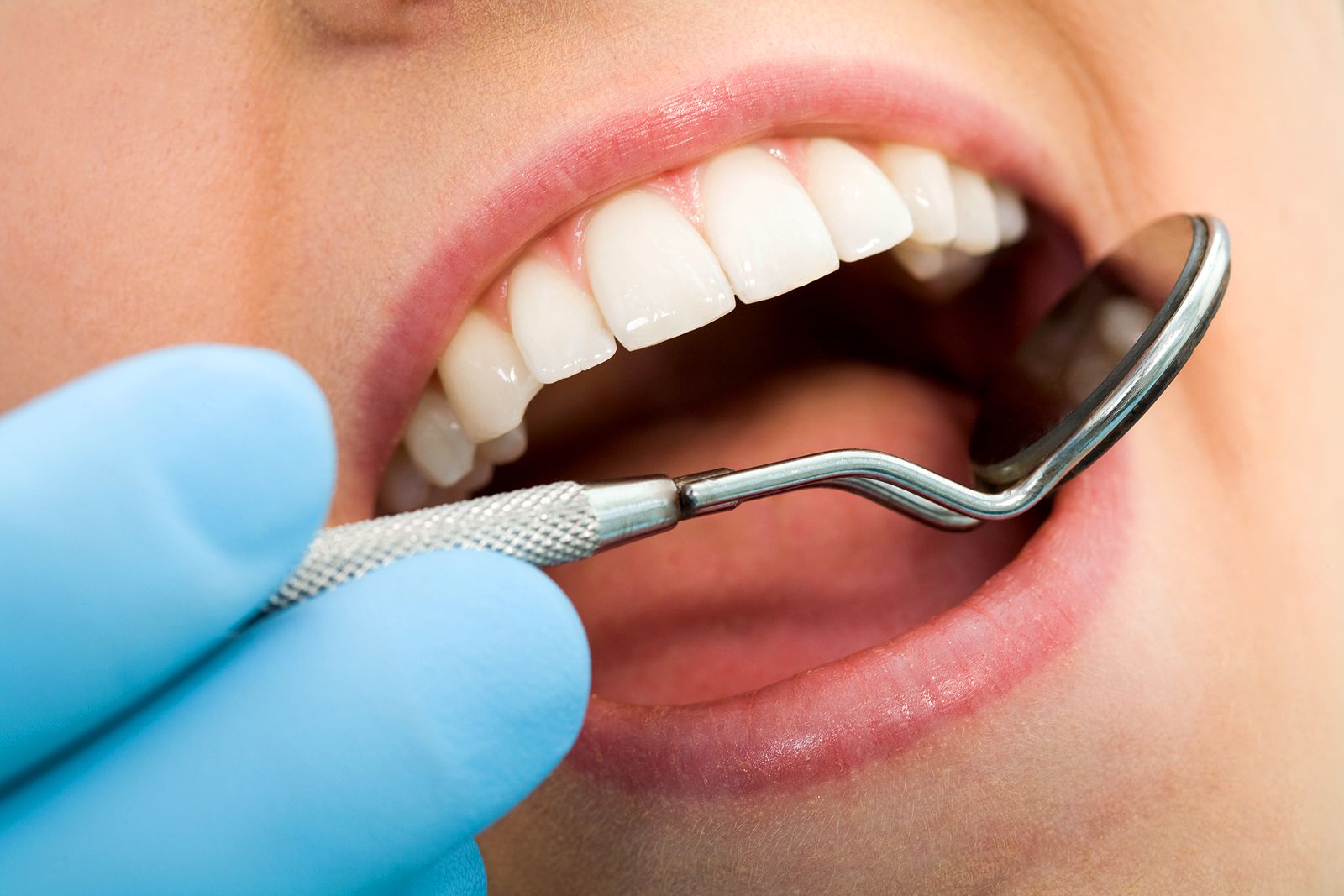 Falsos mitos sobre la salud bucodental. Foto: Bigstock.