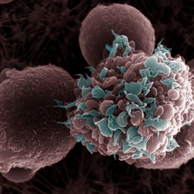 EuropaPress Un antioxidante, el glutatión, parece ser un combustible de las células tumorales EuropaPress Un antioxidante, el glutatión, parece ser un combustible de las células tumorales