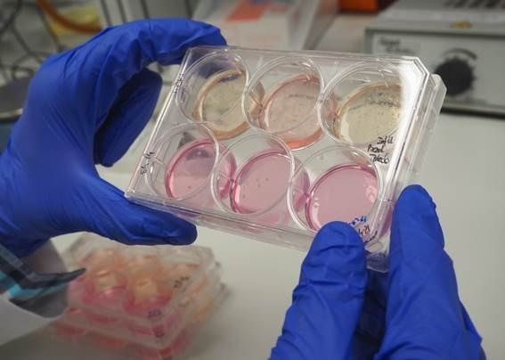 EuropaPress El glutatión, clave inesperada en la alimentación del cáncer