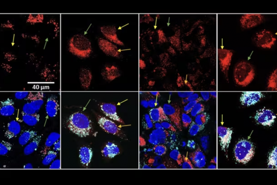 Nueva estrategia frente al cáncer consigue 'in vitro' mayor muerte celular con menos quimioterapia (Foto: ICMM) Nueva estrategia frente al cáncer consigue 'in vitro' mayor muerte celular con menos quimioterapia (Foto: ICMM)