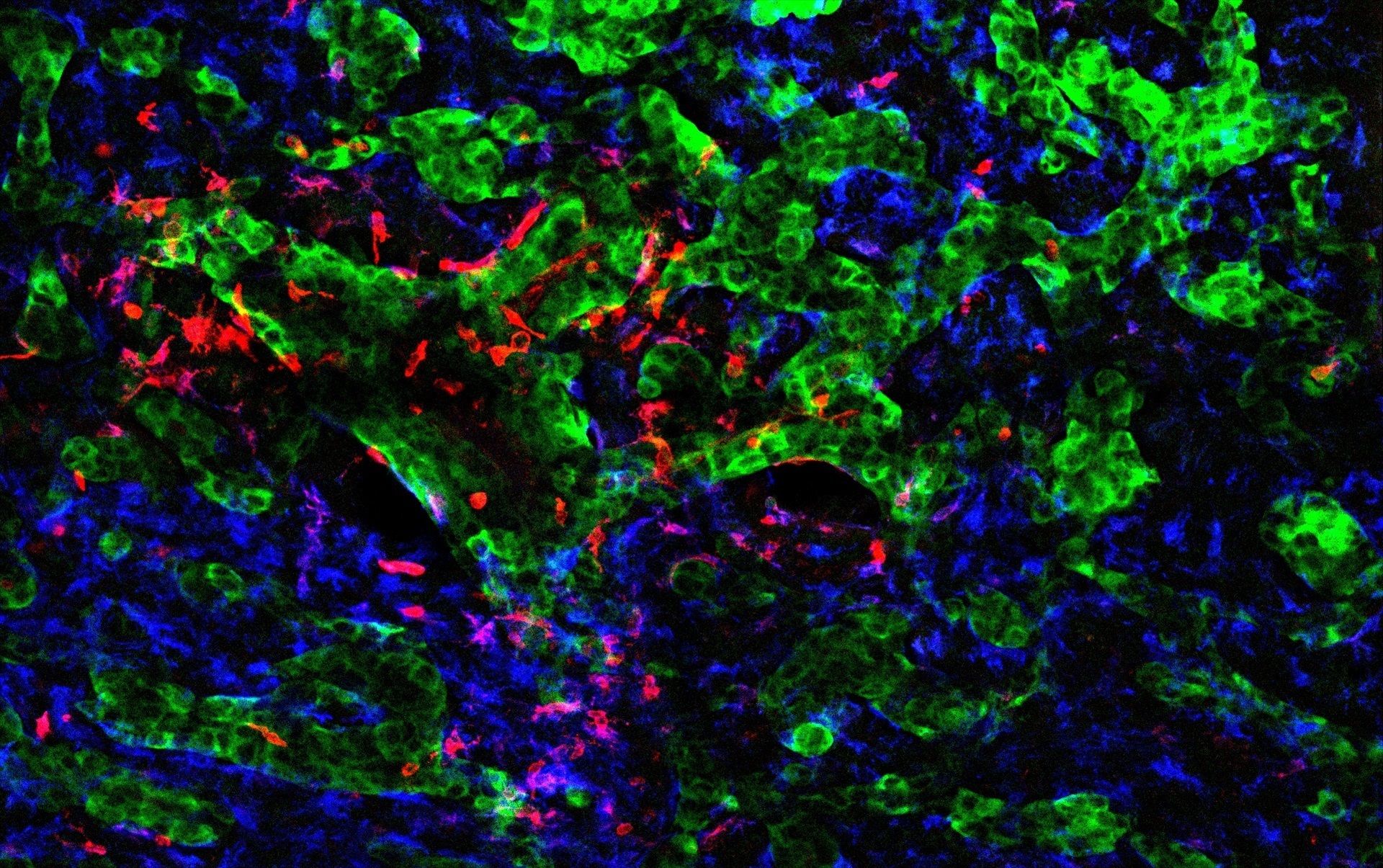 Un hallazgo del CNIO revela cómo el cerebro es reprogramado para favorecer la metástasis. Foto: Europa Press.