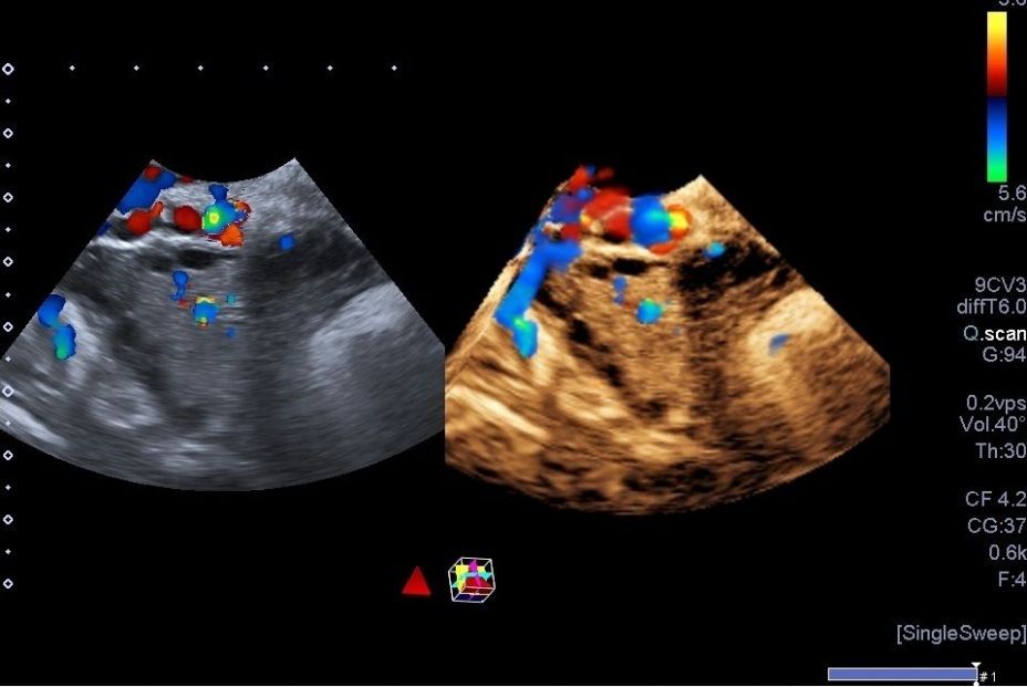 El SOP afecta a entre el 5 y el 10 % de las mujeres en edad fértil. Fuente: Europa Press. El SOP afecta a entre el 5 y el 10 % de las mujeres en edad fértil. Fuente: Europa Press.