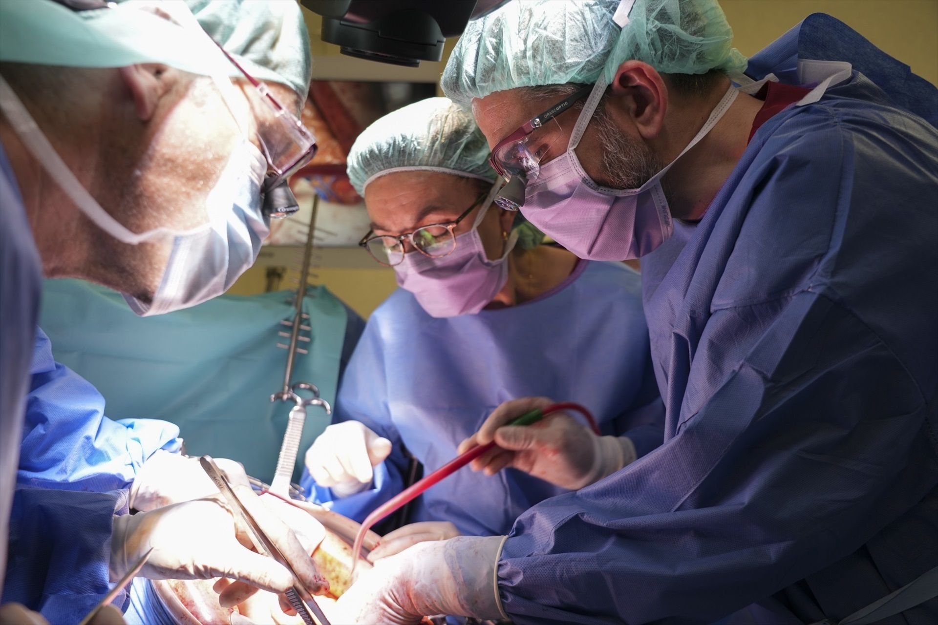 Extirpan por primera vez en España dos cánceres de páncreas con doble by-pass