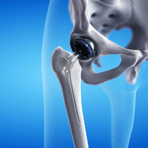 Las graves consecuencias para los mayores en relación a las prótesis e implantes defectuosos
