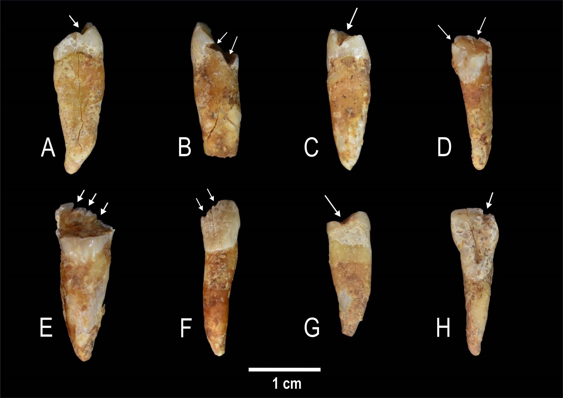 ¿Cómo se construía la identidad de género en la Prehistoria? Las marcas en los dientes lo revelan. Fuente: Europa Press.