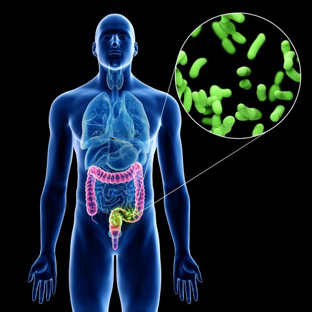 artritis reactiva infección intestinal