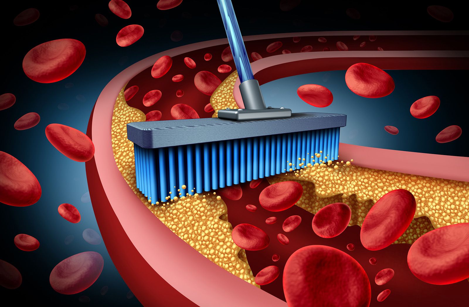¿Es realmente efectiva la terapia de quelación para la enfermedad coronaria?