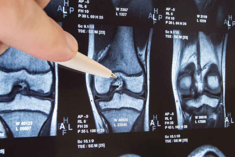 10 minutos, 4 ejercicios  y 0 material es lo que necesitas para aliviar tu dolor de rodillas