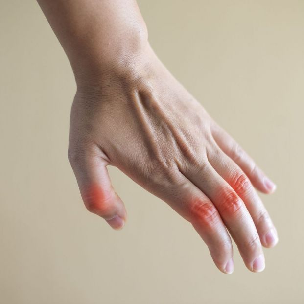 Fisioterapia artritis manos(bigstock)