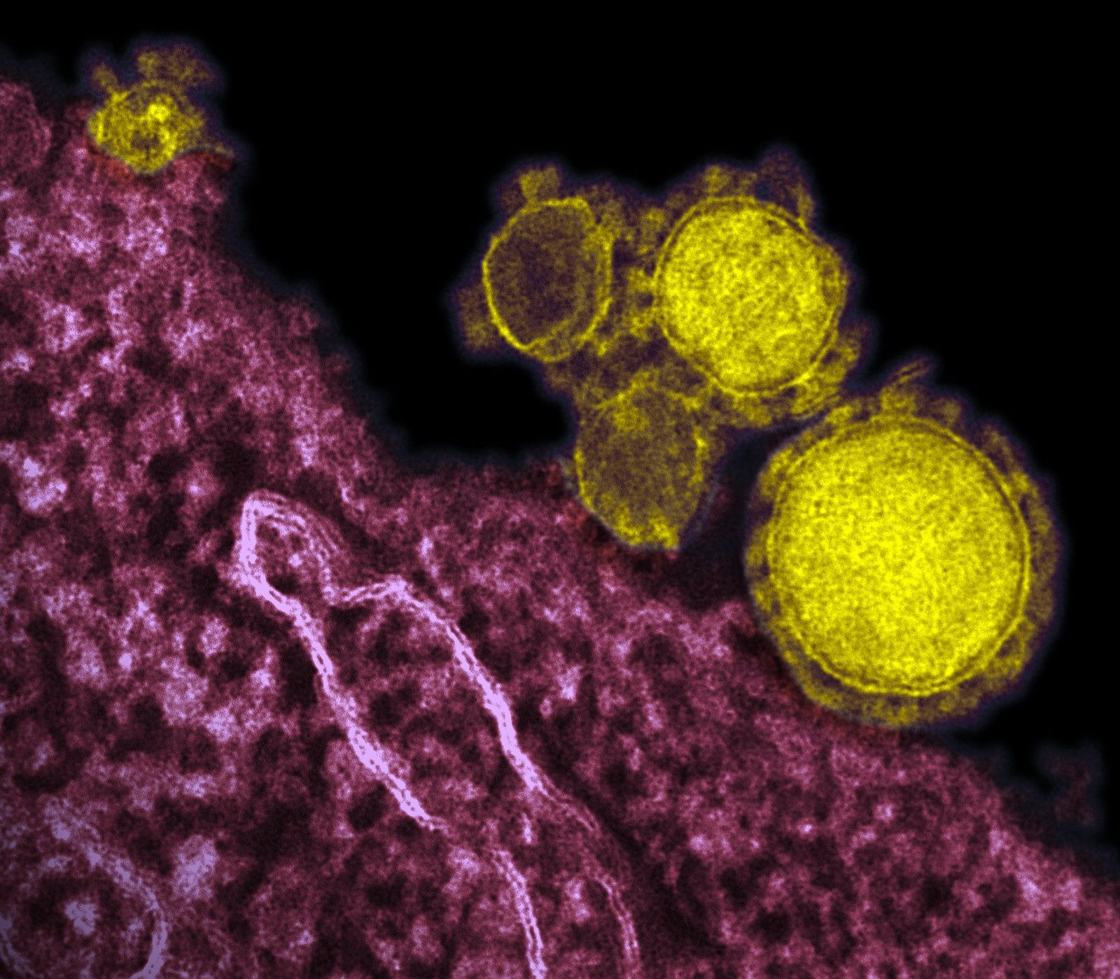 Elaboran un protocolo de actuación ante sospechas de casos de coronavirus en España