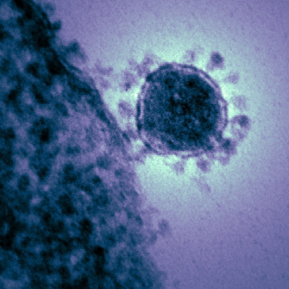 ¿Qué es el coronavirus?