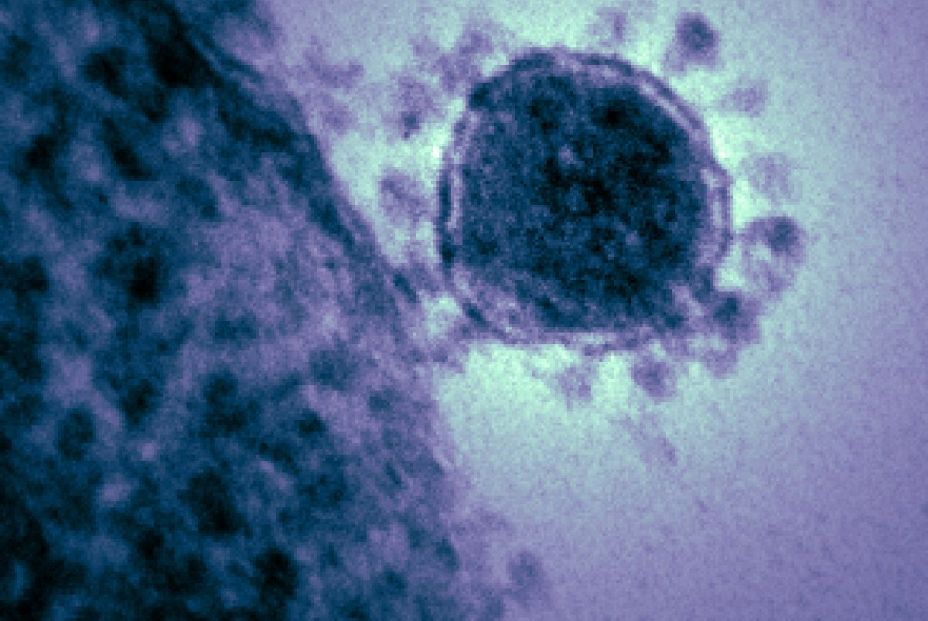  Imagen de archivo de un coronavirus