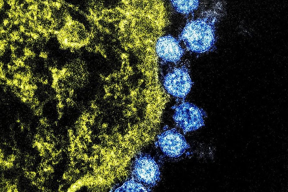 Sanidad estudia dos posibles casos de coronavirus en España