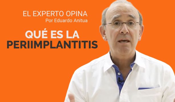 ¿Qué es la periimplantitis? Cómo evitarla o tratarla sin pérdida de hueso