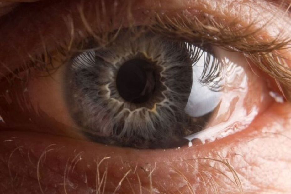 Foto: Bigstock. Foto: Bigstock.