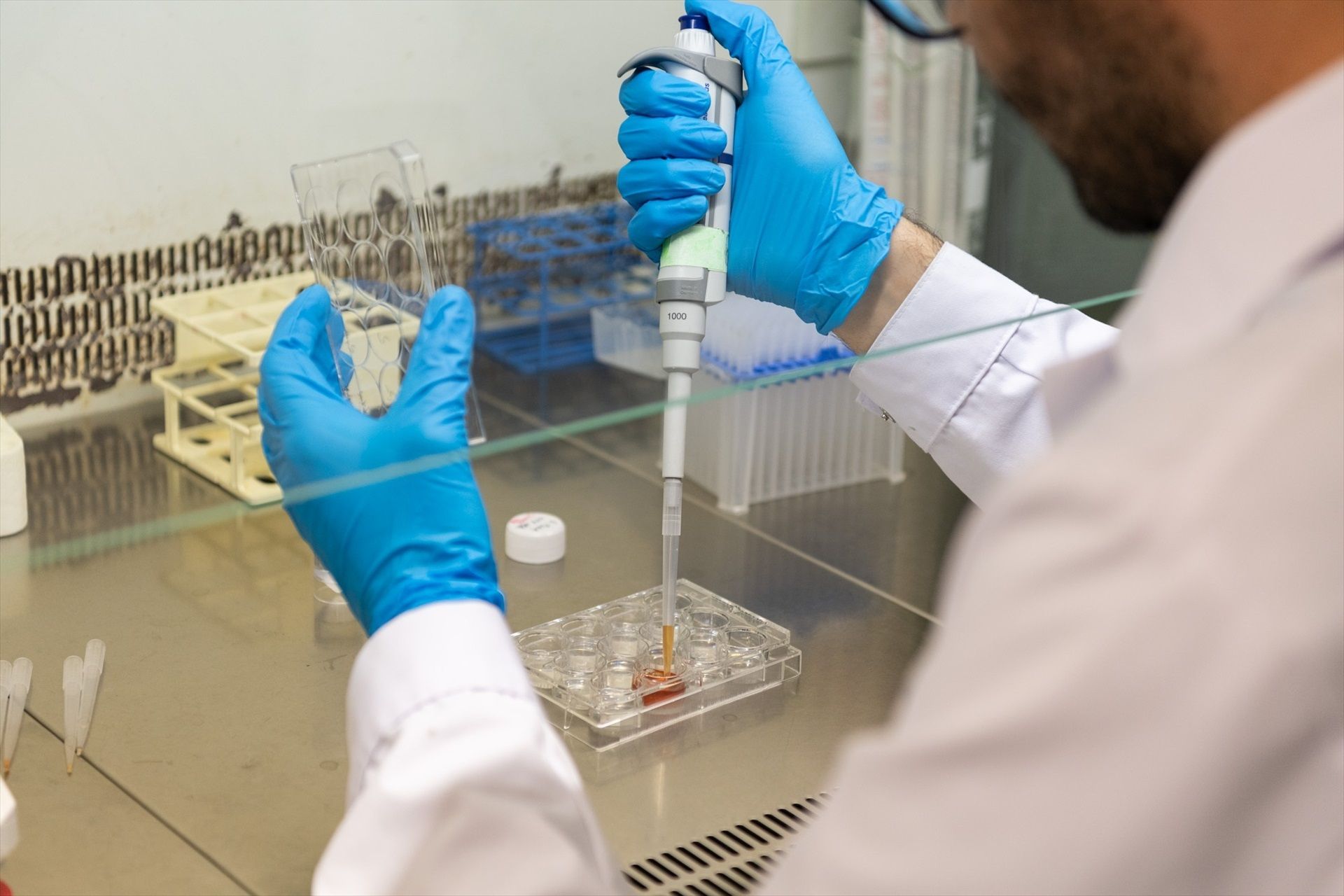 Un nuevo hidrogel inteligente reduce los tiempos de recuperación de fracturas de huesos Un nuevo hidrogel inteligente reduce los tiempos de recuperación de fracturas de huesos