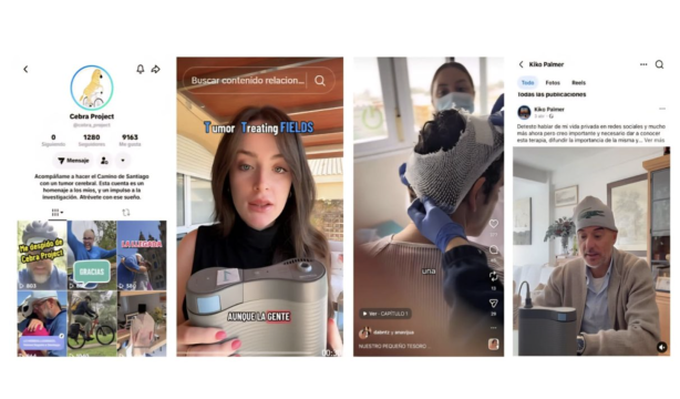 Las redes sociales sacan del silencio al glioblastoma, el tumor cerebral más agresivo