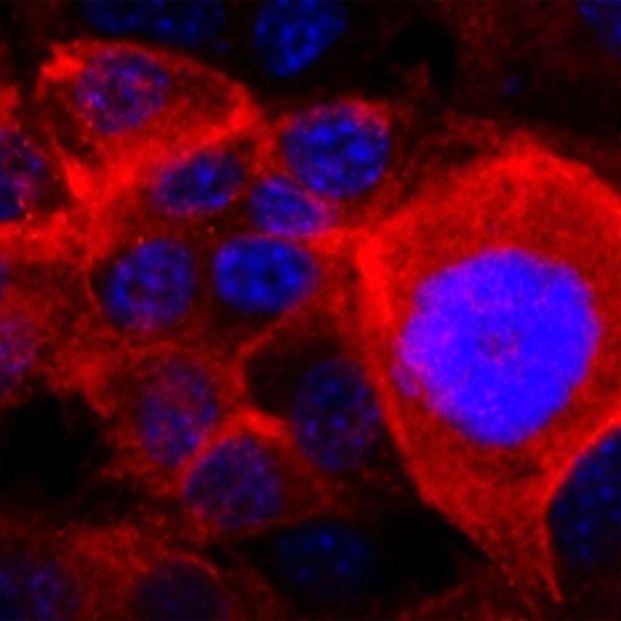 Golpe al cáncer de pulmón: logran una "marcada regresión" degradando la proteína KRAS