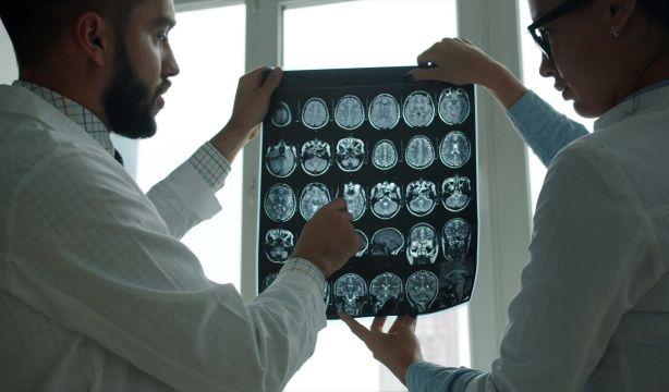ASTUCE Spain reclama cambios urgentes a nivel asistencial para pacientes con tumores cerebrales